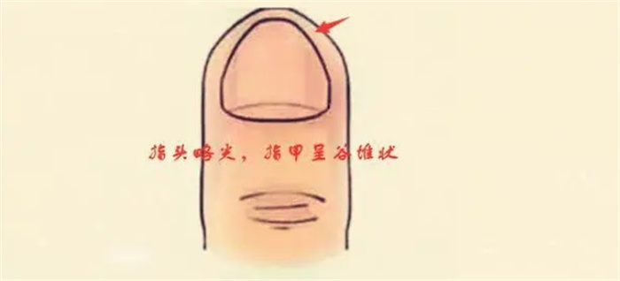 һָǬķNָΠǸǸFķNʲô